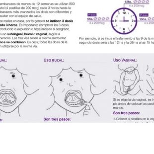 Primer folleto oficial sobre Aborto con Misoprostol: “Para nosotros es un logro contar con un material de accesibilidad»